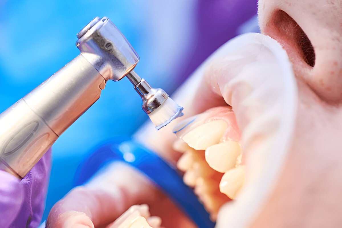 professional cleanings near you